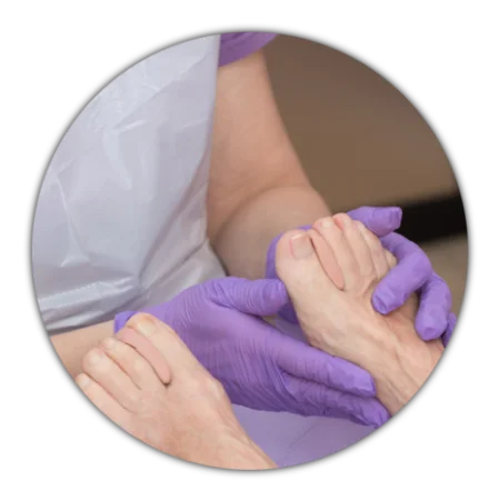 Basisbehandeling pedicurosa